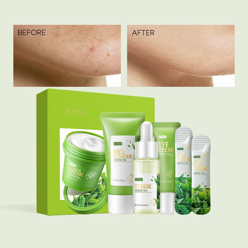 Green tea skin care products sets